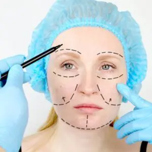 кругова підтяжка обличчя