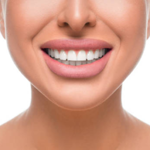 installation of dental implants in Turkey