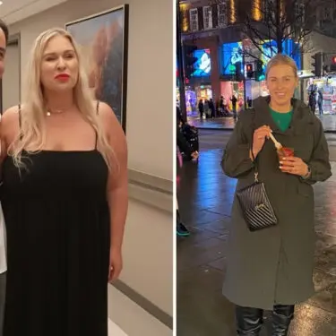 4 місяця після рукавної резекції шлунка