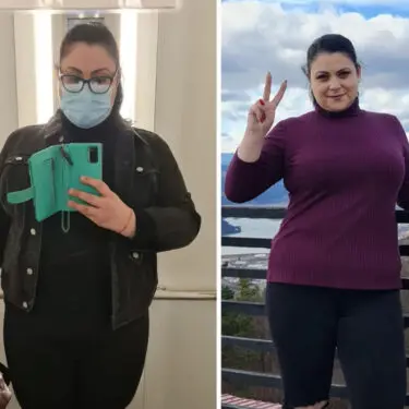 - 30 кг після рукавної резекції шлунка