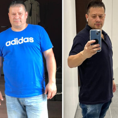 2 month after gastric sleeve