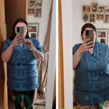 1,5 month after gastric sleeve