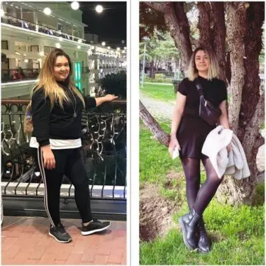 Зменшення шлунка для зниження ваги