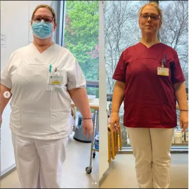 Зменшення шлунка для зниження ваги