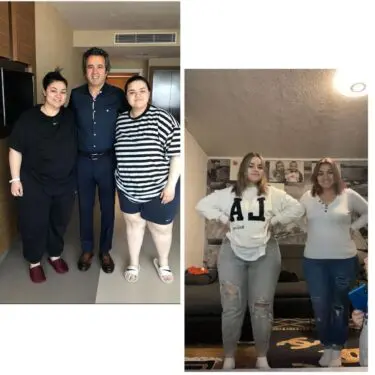 Зменшення шлунка для зниження ваги