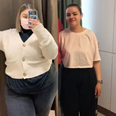 Зменшення шлунка для зниження ваги