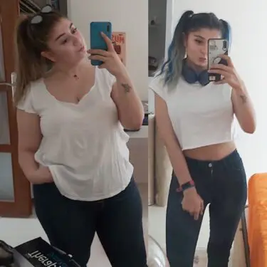 Зменшення шлунка для зниження ваги