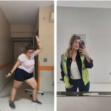 Зменшення шлунка для зниження ваги