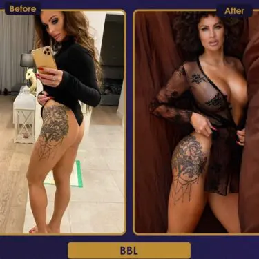 BBL