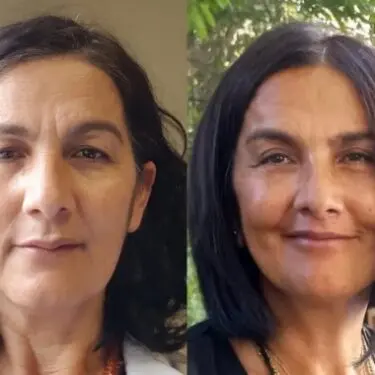 Cirugía de cara y cuello 