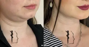 Cirugía de cara y cuello 