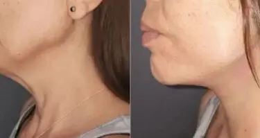 Cirugía de cara y cuello 