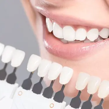 Veneers in der Türkei