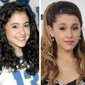 пластическая операция на веках