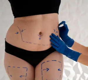 body correction after childbirth