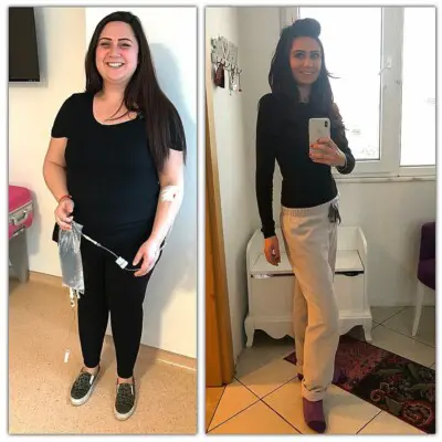 Bypass gástrico en Turquía