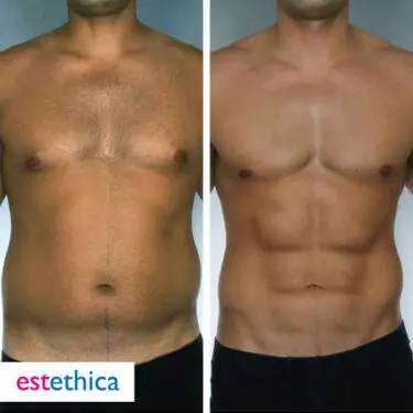 6 Packs