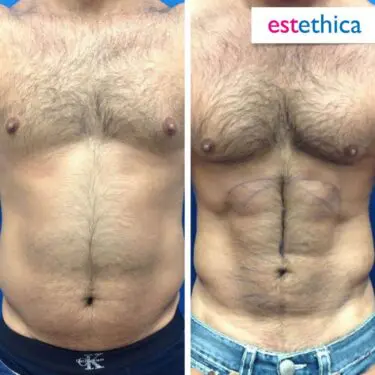 6 Packs