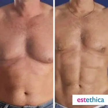 6 Packs