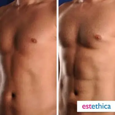 6 Packs