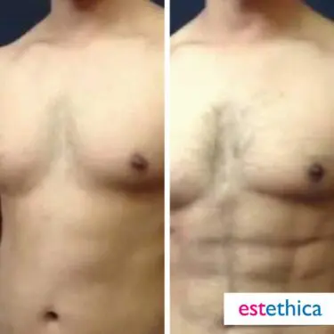 6 Packs
