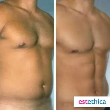 6 Packs