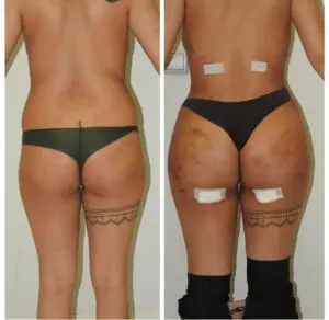  surgery to correct the body after childbirth
