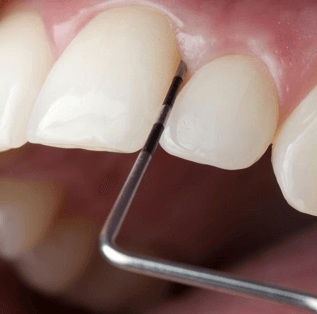 Пародонтология