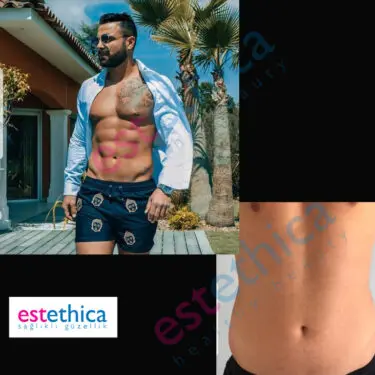 6 Packs