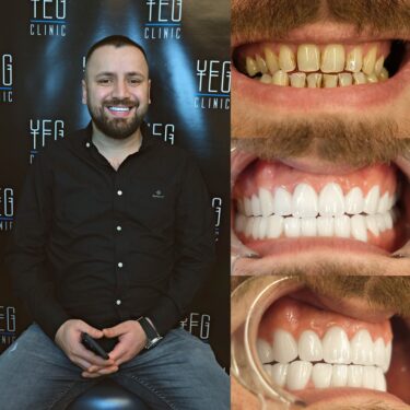 Tratamiento dental en Turquía
