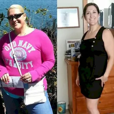 Gastric balloon in Turkey