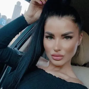 Rhinoplastik