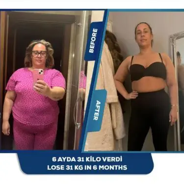 Bariatrische Chirurgie bei Adipositas