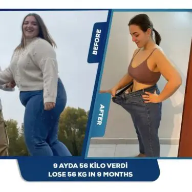Bariatrische Chirurgie bei Adipositas