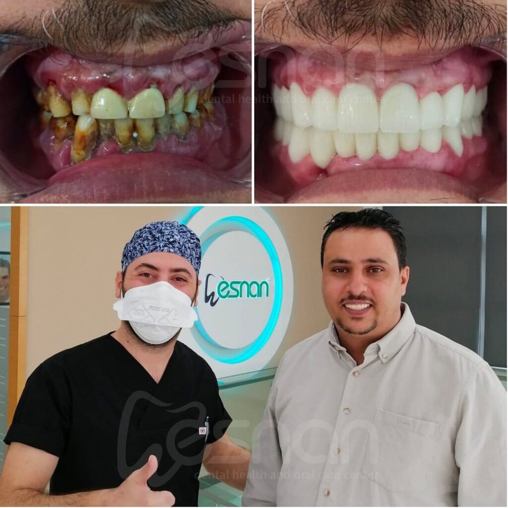 Dental treatment in Turkey