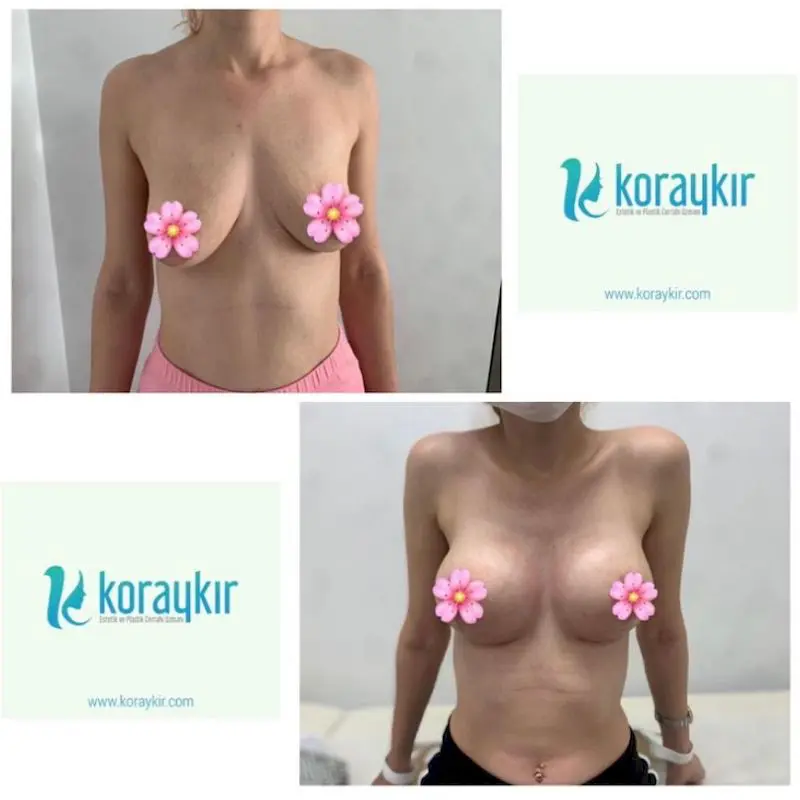 Yalangoch hamshiralar katta eshak bilan stol ustida doggy uslubi