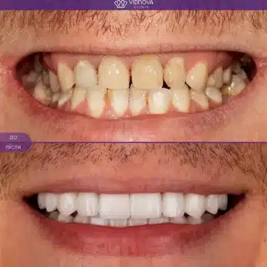 Dentisterie esthétique