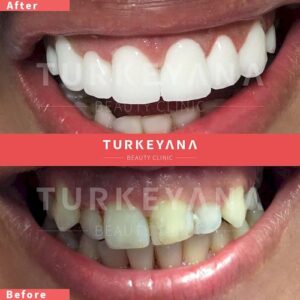 dentistry in istanbul