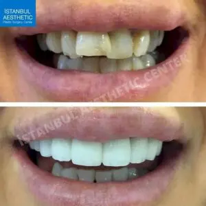 best clinic in turkey for dental treatment