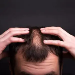 Пересадка волос в Турции стоимость