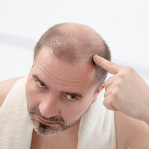 what's the best hair transplant