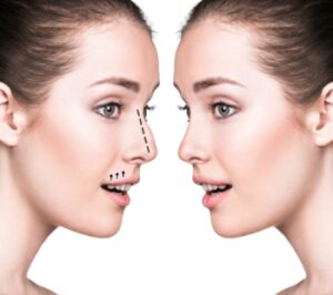 Septoplasty and rhinoplasty: what are the differences, can two operations be done at the same time?