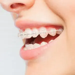 Dental clinics in Antalya reviews 