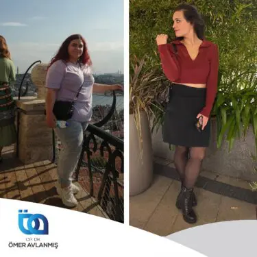 Chirurgie bariatrique (bypass gastrique)