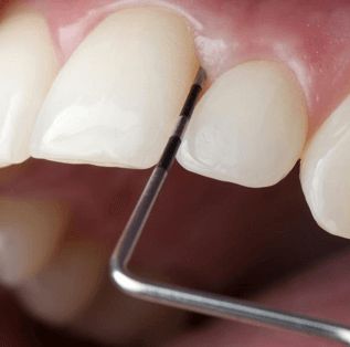 Пародонтология