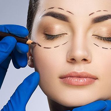 Blépharoplastie