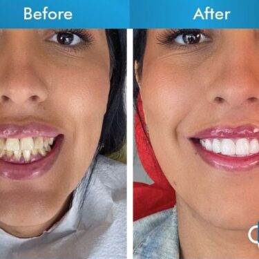 Aesthetic dentistry 