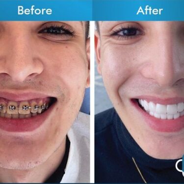 Aesthetic dentistry 
