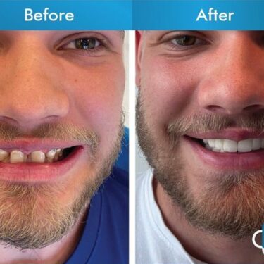 Aesthetic dentistry 
