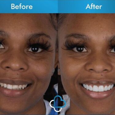Aesthetic dentistry 